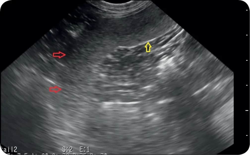 Śledziona u psa: jakie choroby jej dotyczą i jak skutecznie leczyć?