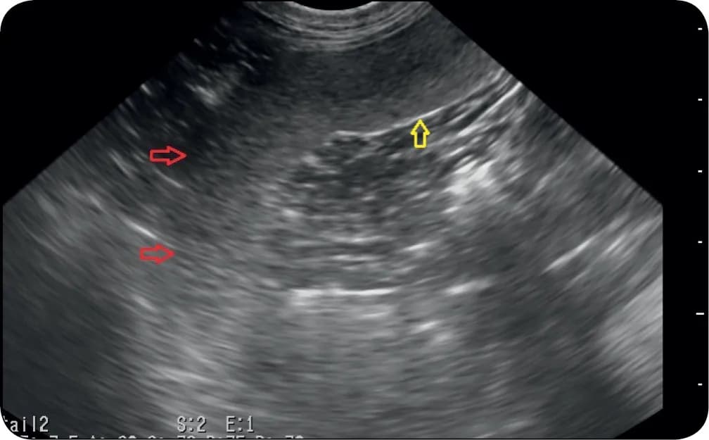 Śledziona u psa: jakie choroby jej dotyczą i jak skutecznie leczyć?