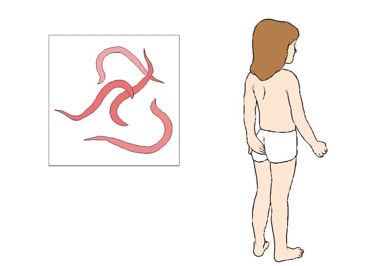 Objawy odrobaczania u dzieci – jak rozpoznać infekcję pasożytniczą?